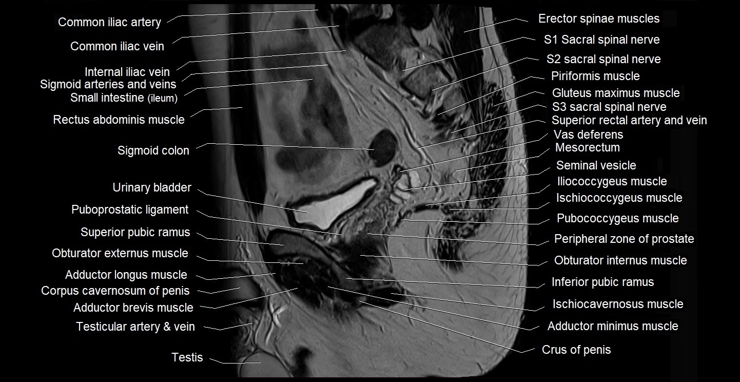 male pelvis sagittal cross sectional anatomy 3T mri image 18.webp